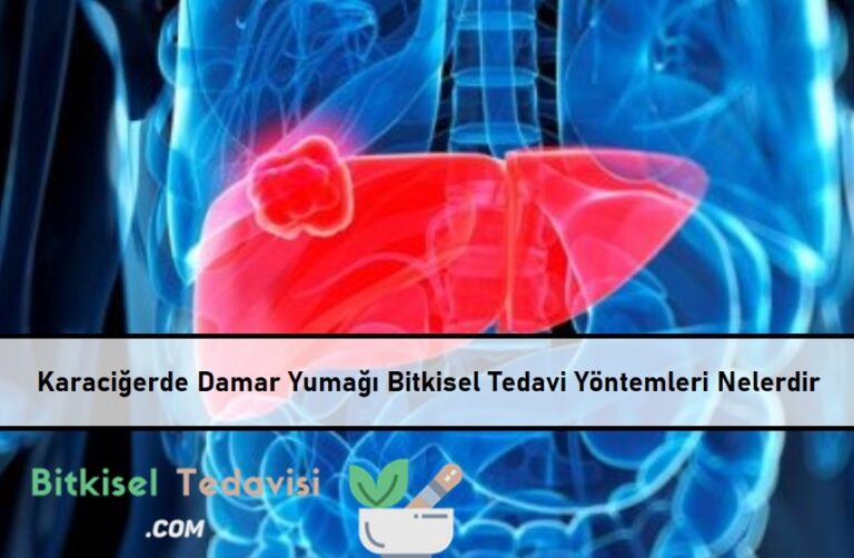 Karaciğerde Damar Yumağı Bitkisel Tedavisi Bitkisel Tedavi