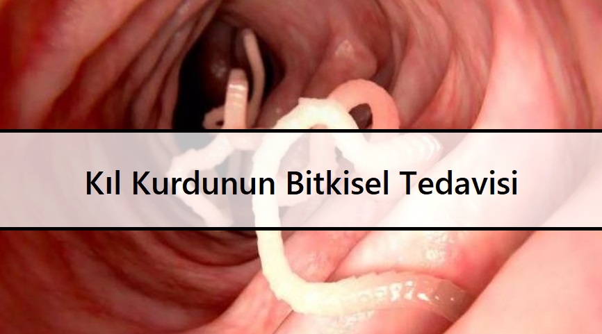 Kıl Kurdunun Bitkisel Tedavisi