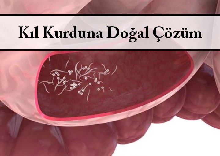 Kıl Kurduna Doğal Çözüm