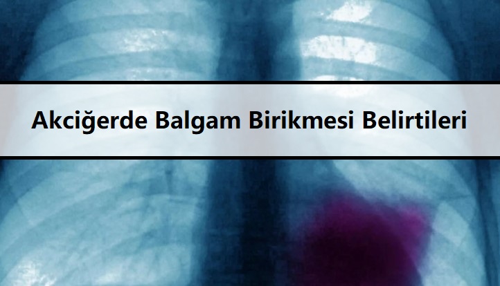 Akciğerde Balgam Bi