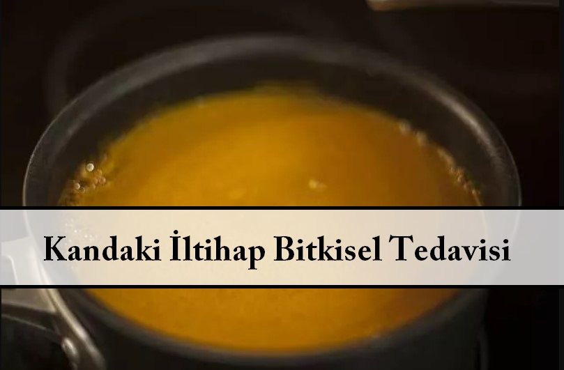 Kandaki İltihap Bitkisel Tedavisi