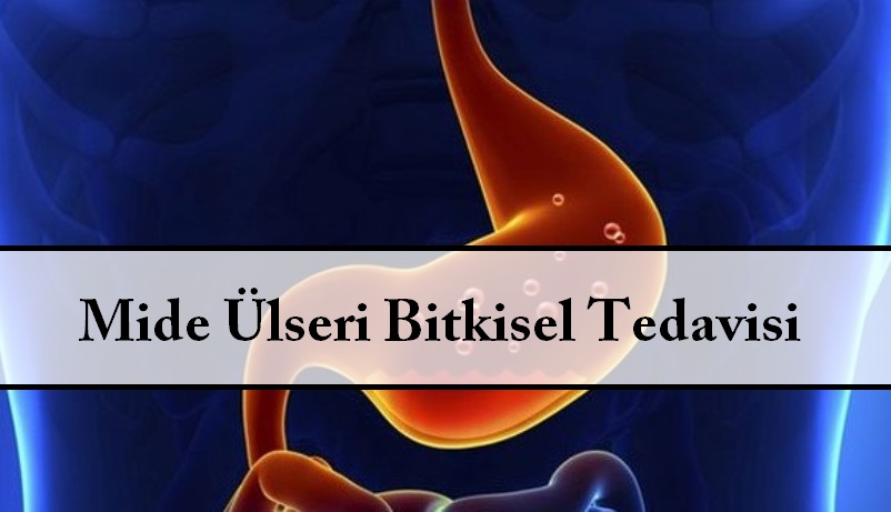 Mide Ülseri Bitkisel Tedavisi