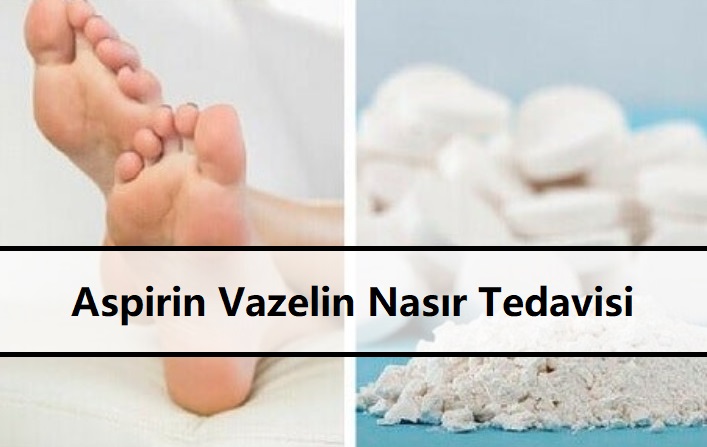 Aspirin Vazelin Nasır Tedavisi