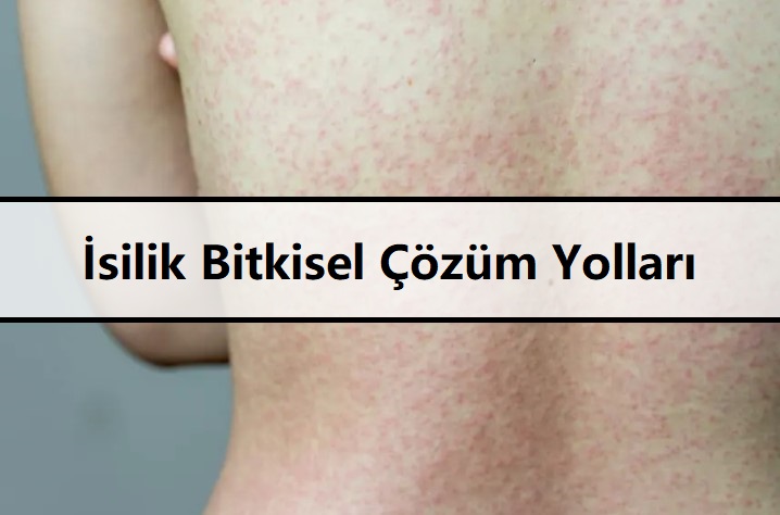 İsilik Bitkisel Çözüm Yolları