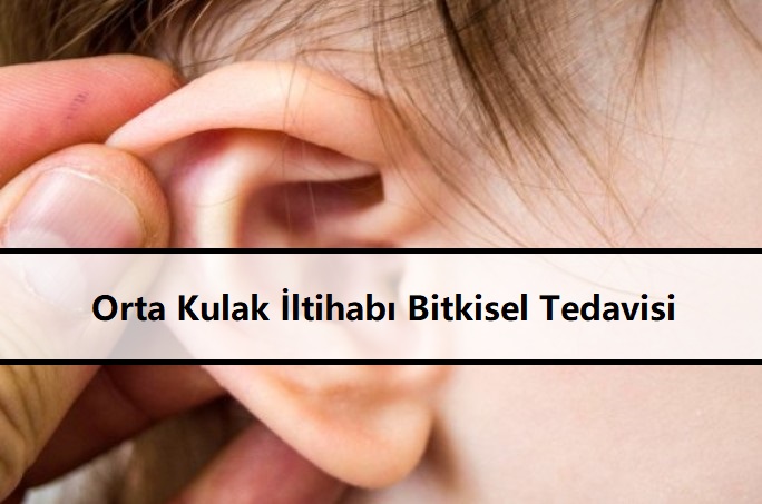 Orta Kulak İltihabı Bitkisel Tedavisi