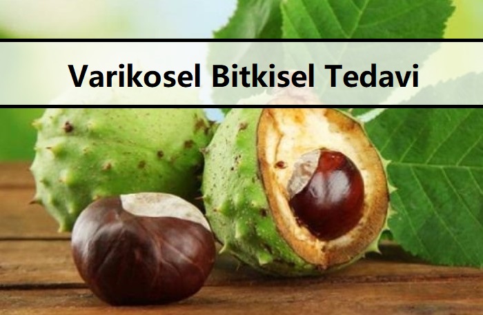 Varikosel Bitkisel Tedavi