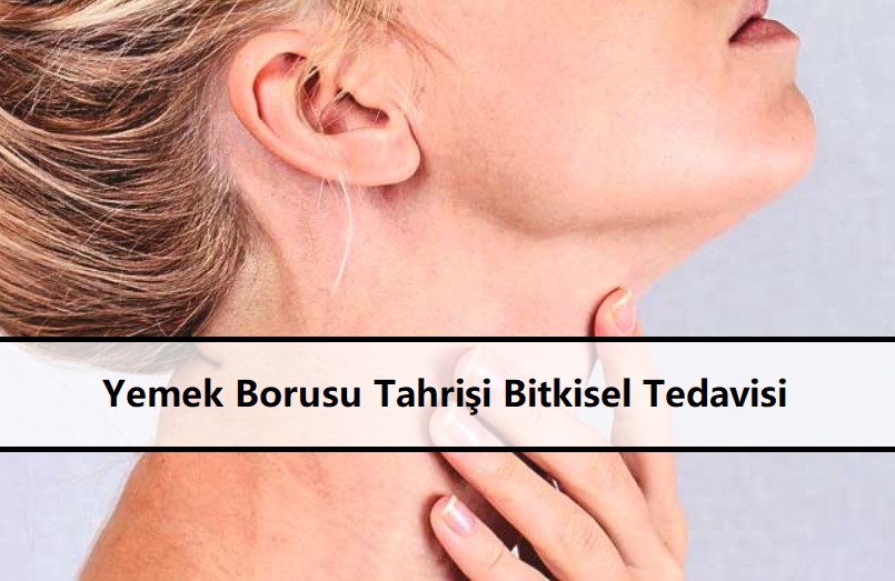 Yemek Borusu Tahrişi Bitkisel Tedavisi