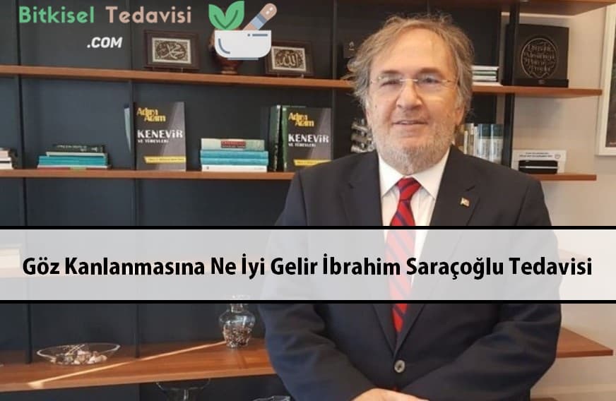 Göz Kanlanmasına Ne İyi Gelir İbrahim Saraçoğlu Tedavisi