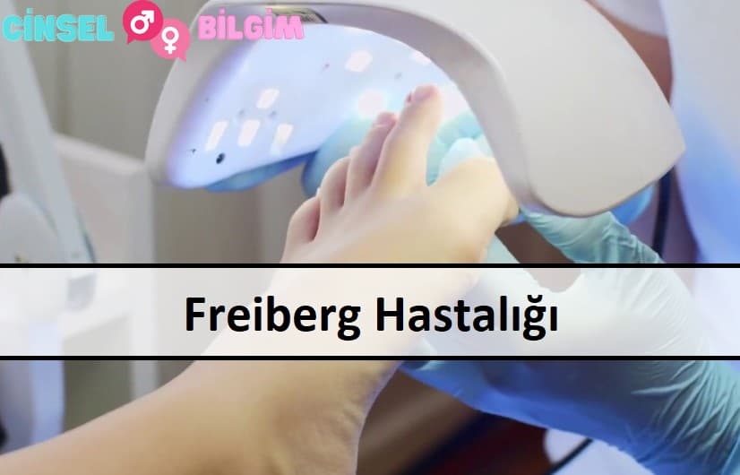 Freiberg Hastalığı