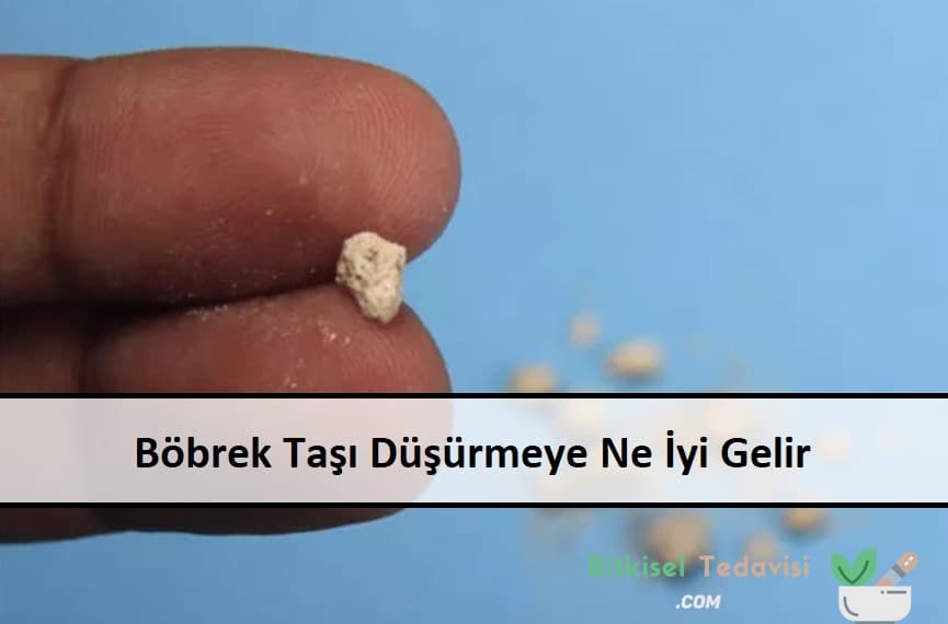 Böbrek Taşı Düşürmeye Ne İyi Gelir ana