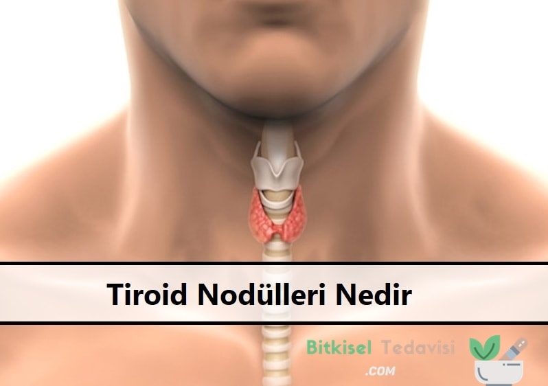 Tiroid Nodülleri Nedir