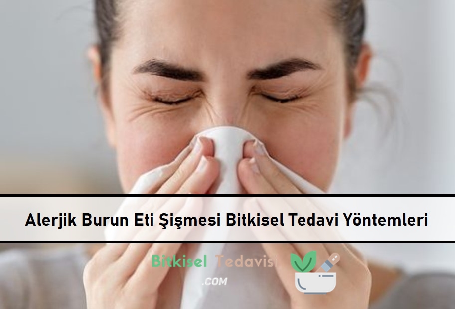 Alerjik Burun Eti Şişmesi Bitkisel Tedavi Yöntemleri