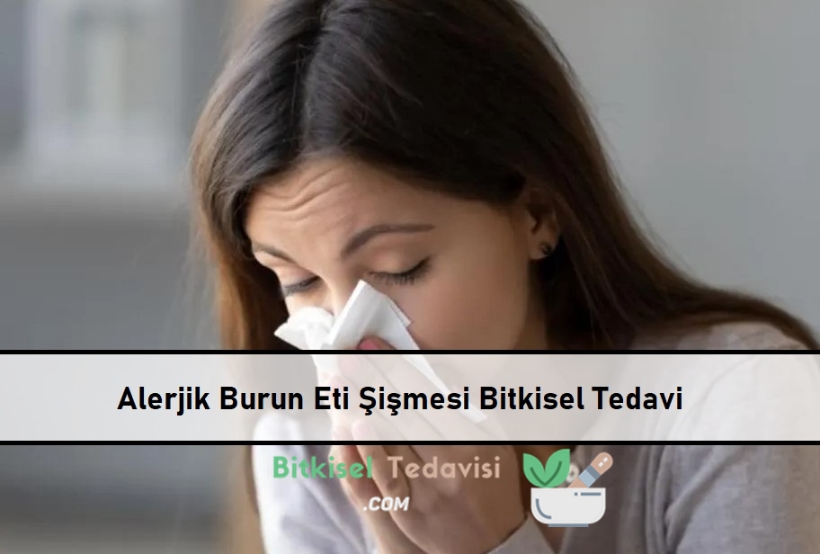 Alerjik Burun Eti Şişmesi Bitkisel Tedavi