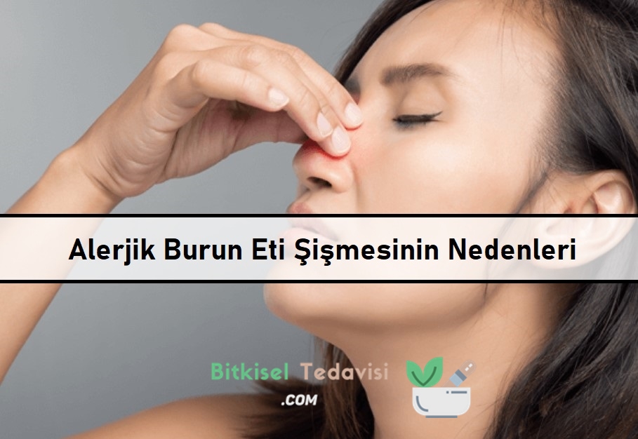 Alerjik Burun Eti Şişmesinin Nedenleri