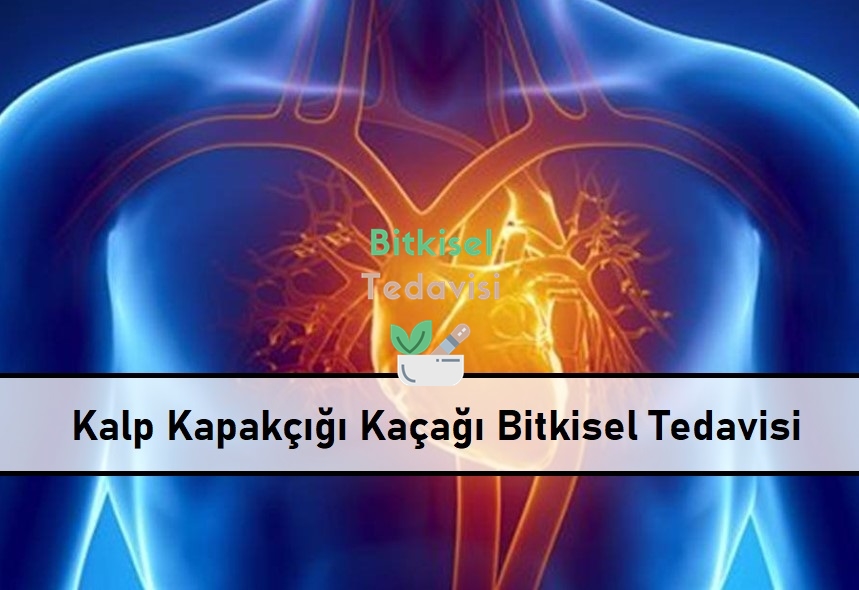 Kalp Kapakçığı Kaçağı Bitkisel Tedavisi