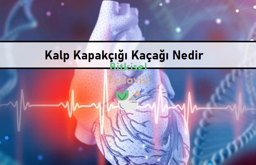 Kalp Kapakçığı Kaçağı Nedir