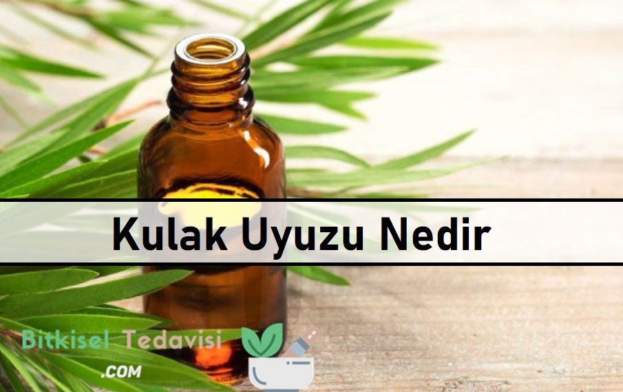 Kulak Uyuzu Nedir