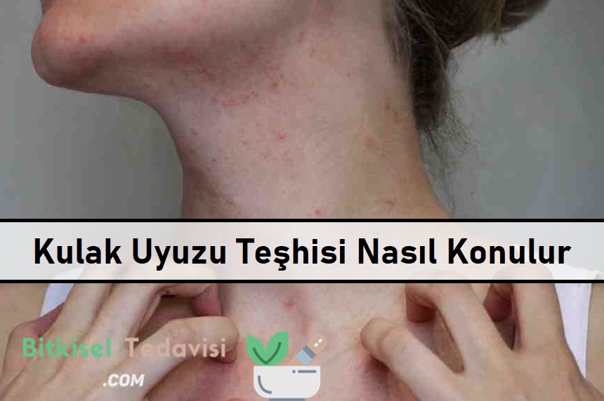 Kulak Uyuzu Teşhisi Nasıl Konulur