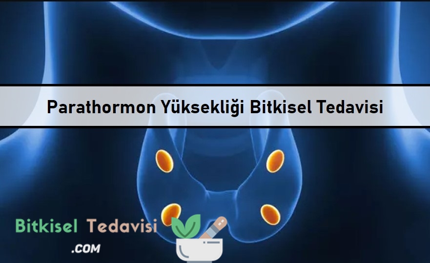 Parathormon Yüksekliği Bitkisel Tedavisi