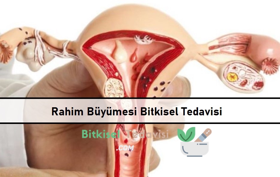 Rahim Büyümesi Bitkisel Tedavisi