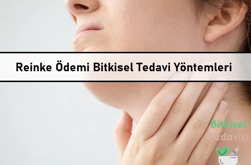 Reinke Ödemi Bitkisel Tedavi Yöntemleri